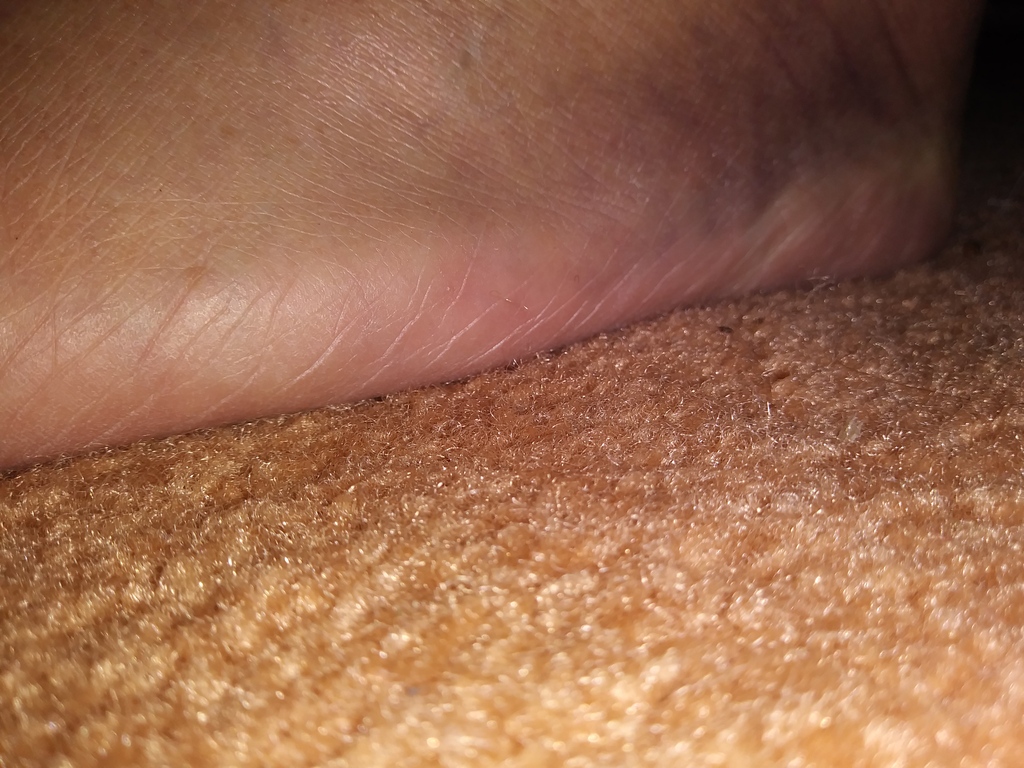 No description provided for: /2019/04-06/0514-injured-foot/photo02.html